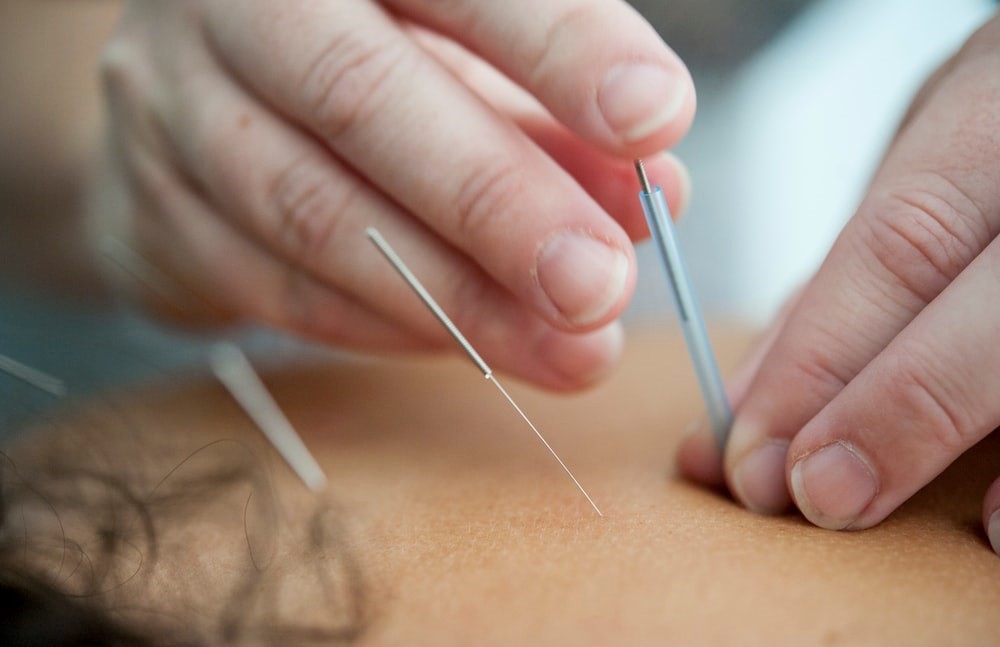 How Acupuncture Helps With Chronic Pain Conditions