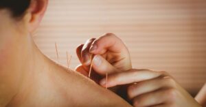 someone is receiving acupuncture in there upper back to relieve back pain and feel better.. it shows the hands of the acupuncturist inserting the needle into the person